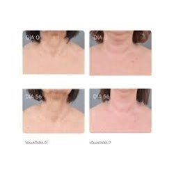 GEMA HERRERIAS  25 PEPTIDOS-TH CREMAGEL ROLL-ON 40 ML HERRERIAS